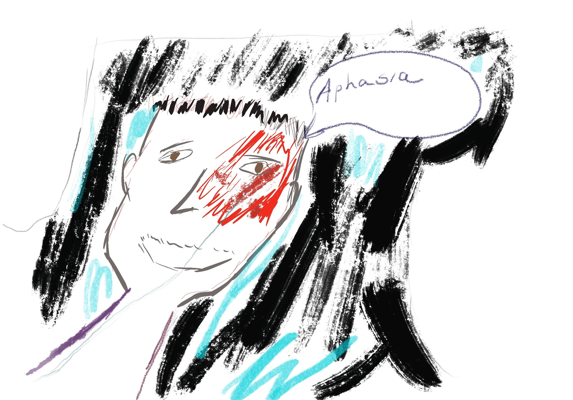 Aphasia